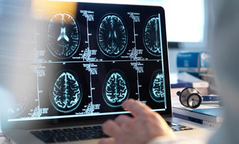doctor viewing brain scan on laptop