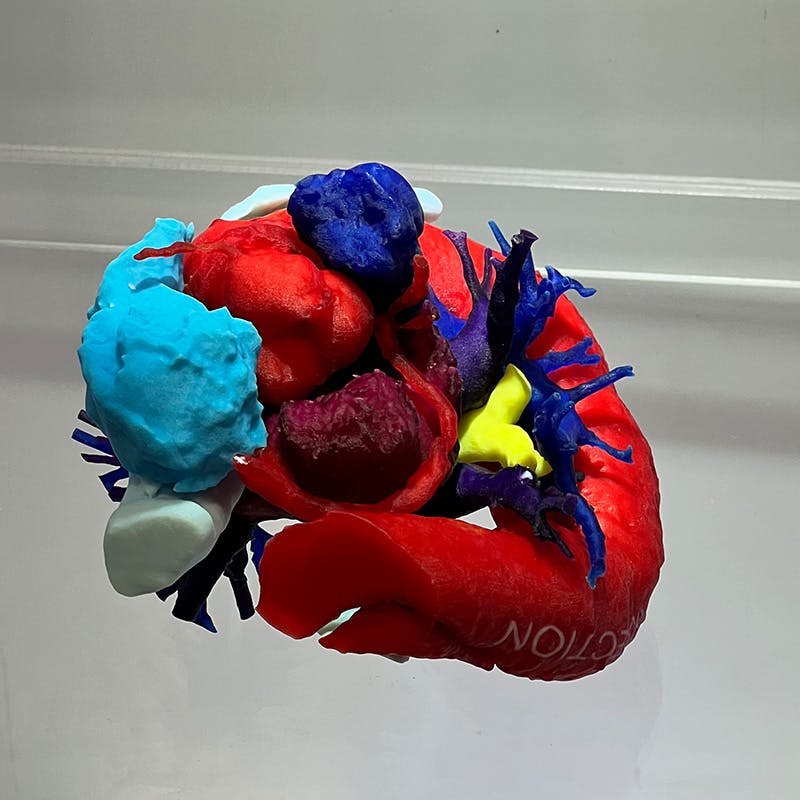 Ricoh 3D anatomic models gain FDA 510(k) clearance